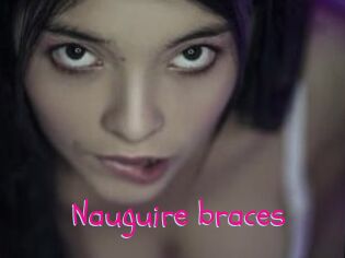 Nauguire_braces